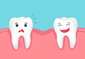 porcelain-veneers-gapedtooth