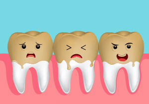 porcelain-veneers-stainedtooth
