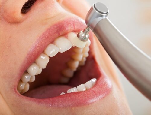 Do’s and Don’ts: Your Complete Guide to Professional Teeth Whitening Treatments in Airdrie