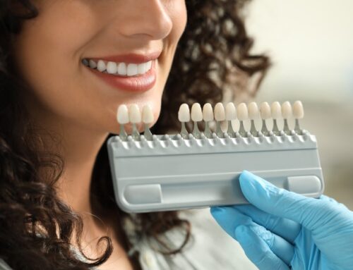 Smile Transformations: What You Should Know About Porcelain Veneers